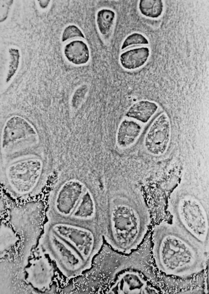 Light micrograph of an undecalcified epiphyseal plate that is displaying the hypertrophic zone with its typical chondrocytes, matrix and three zones: maturation (top), degenerative (middle) and provisional calcification (bottom).